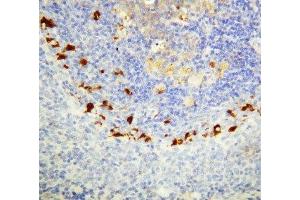 IHC-P: SOCS1 antibody testing of rat spleen tissue (SOCS1 Antikörper  (C-Term))