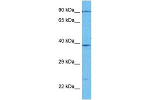 Host:  Rabbit  Target Name:  PLMN  Sample Type:  Jurkat Whole Cell lysates  Antibody Dilution:  1. (PLG Antikörper  (Middle Region))