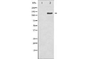 Western blot analysis of FAK phosphorylation expression in 293 whole cell lysates,The lane on the left is treated with the antigen-specific peptide. (FAK Antikörper  (pTyr925))