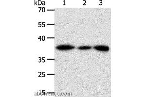 Western blot analysis of Human liver cancer tissue, hela cell and human fetal kidney tissue, using AKR1A1 Polyclonal Antibody at dilution of 1:450 (AKR1A1 Antikörper)