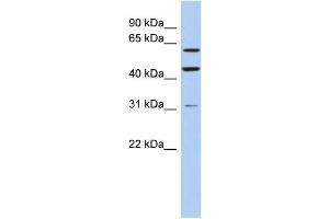 WB Suggested Anti-ZNF179 Antibody Titration:  0. (RNF112 Antikörper  (Middle Region))