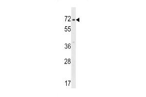 Western blot analysis in HepG2 cell line lysates (35ug/lane). (ZNF155 Antikörper  (C-Term))