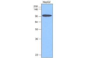 Western Blotting (WB) image for anti-Hexokinase 1 (HK1) antibody (ABIN306422) (Hexokinase 1 Antikörper)