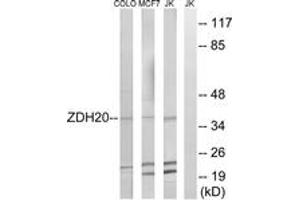 Western blot analysis of extracts from Jurkat/MCF-7/COLO cells, using ZDHHC20 Antibody. (ZDHHC20 Antikörper  (AA 72-121))