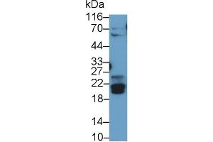 Detection of BNIP3 in Rat Skeletal muscle lysate using Polyclonal Antibody to Bcl2/Adenovirus E1B 19 kDa Interacting Protein 3 (BNIP3) (BNIP3 Antikörper  (AA 3-134))