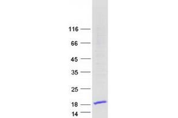 HMGN3 Protein (Transcript Variant 2) (Myc-DYKDDDDK Tag)