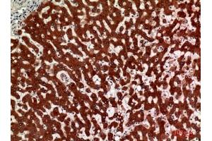 Immunohistochemical analysis of paraffin-embedded human-liver, antibody was diluted at 1:100. (HSD11B1 Antikörper  (N-Term))