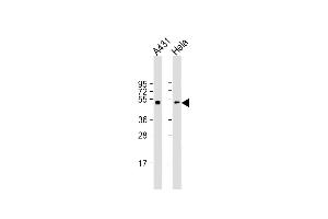 All lanes : Anti-p53 Antibody (S15) at 1:2000 dilution Lane 1: A431 whole cell lysate Lane 2: Hela whole cell lysate Lysates/proteins at 20 μg per lane. (p53 Antikörper  (AA 1-30))