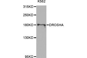 Western blot analysis of extracts of K-562 cells, using DROSHA antibody (ABIN5975795) at 1/1000 dilution. (DROSHA Antikörper)