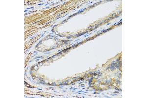 Immunohistochemistry of paraffin-embedded human prostate using CSH1 antibody. (CSH1 Antikörper)