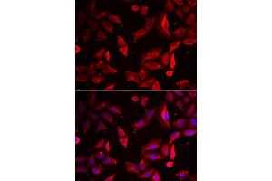 Immunofluorescence analysis of HeLa cells using SERPINB9 antibody (ABIN5973795). (SERPINB9 Antikörper)