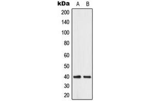 ABHD12B Antikörper  (C-Term)