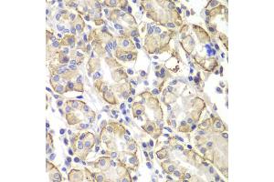 Immunohistochemistry of paraffin-embedded human stomach using Lyn antibody (ABIN4904272) at dilution of 1:100 (40x lens). (LYN Antikörper)