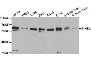 Western blot analysis of extracts of various cell lines, using INHBA antibody. (INHBA Antikörper)