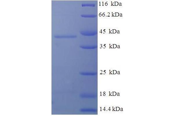 Deoxyguanosine Kinase Protein (DGUOK) (AA 40-277) (His-SUMO Tag)