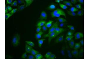 Immunofluorescence staining of Hela cells with ABIN7166575 at 1:133, counter-stained with DAPI. (Otopetrin 1 Antikörper  (AA 414-544))