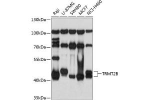 Western blot analysis of extracts of various cell lines, using TRMT2B antibody  at 1:1000 dilution. (TRMT2B Antikörper  (AA 1-250))