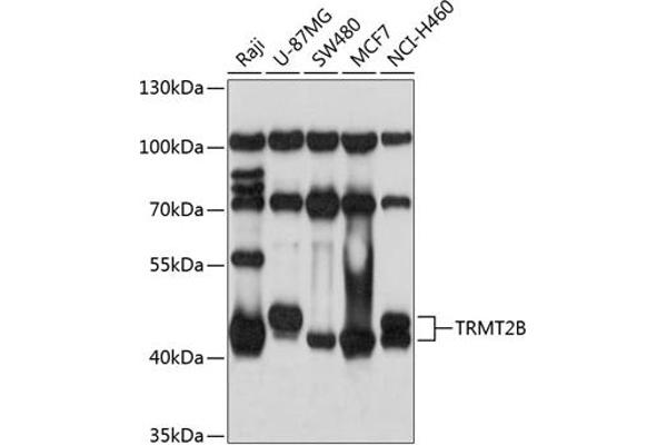 TRMT2B Antikörper  (AA 1-250)