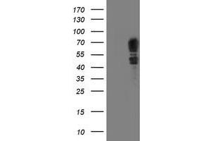 HEK293T cells were transfected with the pCMV6-ENTRY control (Left lane) or pCMV6-ENTRY SCHIP1 (Right lane) cDNA for 48 hrs and lysed. (SCHIP1 Antikörper)