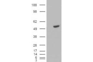 Western Blotting (WB) image for anti-B-Cell Linker (BLNK) (C-Term) antibody (ABIN2465185) (B-Cell Linker Antikörper  (C-Term))