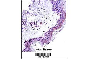 STAT2 Antibody immunohistochemistry analysis in formalin fixed and paraffin embedded human skin tissue followed by peroxidase conjugation of the secondary antibody and DAB staining. (STAT2 Antikörper  (N-Term))