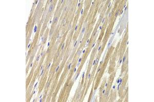 Immunohistochemistry of paraffin-embedded rat heart using GPD1 Antibody. (GPD1 Antikörper)