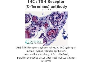 Image no. 1 for anti-Thyroid Stimulating Hormone Receptor (TSHR) (C-Term) antibody (ABIN1740417) (TSH receptor Antikörper  (C-Term))