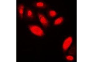 Immunofluorescence (IF) image for anti-Androgen Receptor (AR) antibody (ABIN7303750)