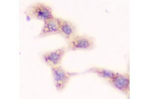 ICC testing of FFPE human A431 cells with SMN1/2 antibody. (SMN1 / SMN2 Antikörper)