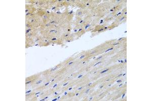 Immunohistochemistry of paraffin-embedded rat heart using RAB24 antibody (ABIN5974578) at dilution of 1/100 (40x lens). (RAB24 Antikörper)