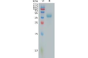 PTTG1IP Protein (AA 33-96) (Fc Tag)