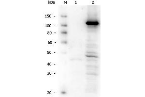 Rabbit anti-hTERT WB Western Blot of Rabbit anti-Telomerase catalytic subunit antibody. (TERT Antikörper  (C-Term))