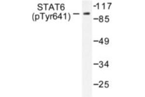 Image no. 1 for anti-Signal Transducer and Activator of Transcription 6, Interleukin-4 Induced (STAT6) (pTyr641) antibody (ABIN318133) (STAT6 Antikörper  (pTyr641))