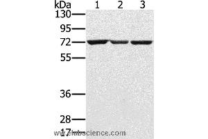 Western blot analysis of Hepg2, A172 and Raji cell, using SLC25A13 Polyclonal Antibody at dilution of 1:450 (slc25a13 Antikörper)