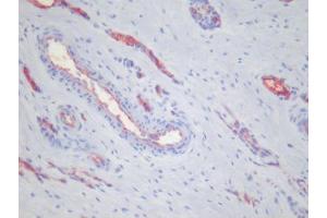 Immunohistochemistry (IHC) image for anti-Platelets antibody (ABIN781796) (Platelets Antikörper)