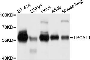 Western blot analysis of extracts of various cell lines, using LPCAT1 antibody (ABIN5972886) at 1/1000 dilution. (LPCAT1 Antikörper)