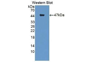 Detection of Recombinant WT1, Human using Polyclonal Antibody to Wilms Tumor Protein (WT1) (WT1 Antikörper  (AA 310-446))