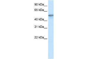 WB Suggested Anti-FOXO3A Antibody Titration:  0. (FOXO3 Antikörper  (C-Term))