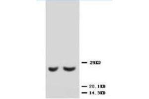 Western blot analysis of rat kidney lysis using TIMP2 antibody (TIMP2 Antikörper  (C-Term))