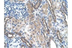 LOC728227 antibody was used for immunohistochemistry at a concentration of 4-8 ug/ml to stain Epithelial cells of renal tubule (arrows) in Human Kidney. (LOC728227 Antikörper  (C-Term))