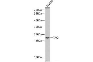 Western blot analysis of extracts of SW620 cells using TAC1 Polyclonal Antibody at dilution of 1:1000. (TAC1 Antikörper)