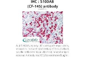 Image no. 1 for anti-S100 Calcium Binding Protein A8 (S100A8) antibody (ABIN1723086) (S100A8 Antikörper)