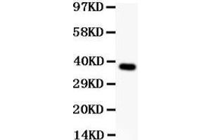 Anti-SynCAM Picoband antibody,  All lanes: Anti SYNCAM  at 0. (CADM1 Antikörper  (AA 45-340))