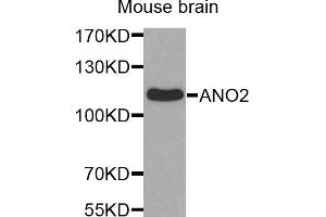 Western blot analysis of extracts of mouse brain, using ANO2 antibody (ABIN5971903). (Anoctamin 2 Antikörper)