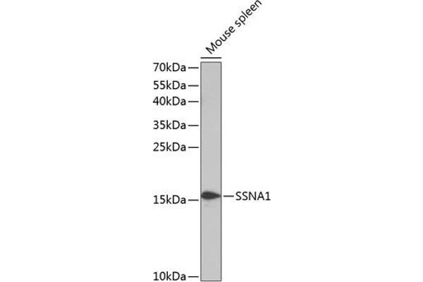 SSNA1 Antikörper  (AA 1-119)