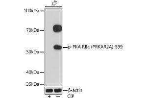 Western blot analysis of extracts of C6 cells, using Phospho-PKA RIIα (PRKA)-S99 Rabbit mAb (ABIN7269661) at 1:1000 dilution. (PRKAR2A Antikörper  (pSer99))