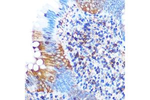 Immunohistochemistry of paraffin-embedded human appendix using PG Rabbit mAb (ABIN1679556, ABIN3018645, ABIN3018646 and ABIN7101637) at dilution of 1:100 (40x lens). (PGAM1 Antikörper)