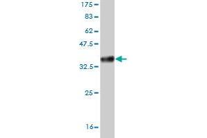 Western Blot detection against Immunogen (34. (HAND2 Antikörper  (AA 135-216))