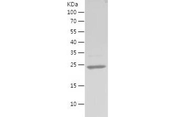 Vimentin Protein (VIM) (AA 2-201) (His tag)