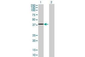 Lane 1: TCEAL4 transfected lysate ( 23. (TCEAL4 293T Cell Transient Overexpression Lysate(Denatured))